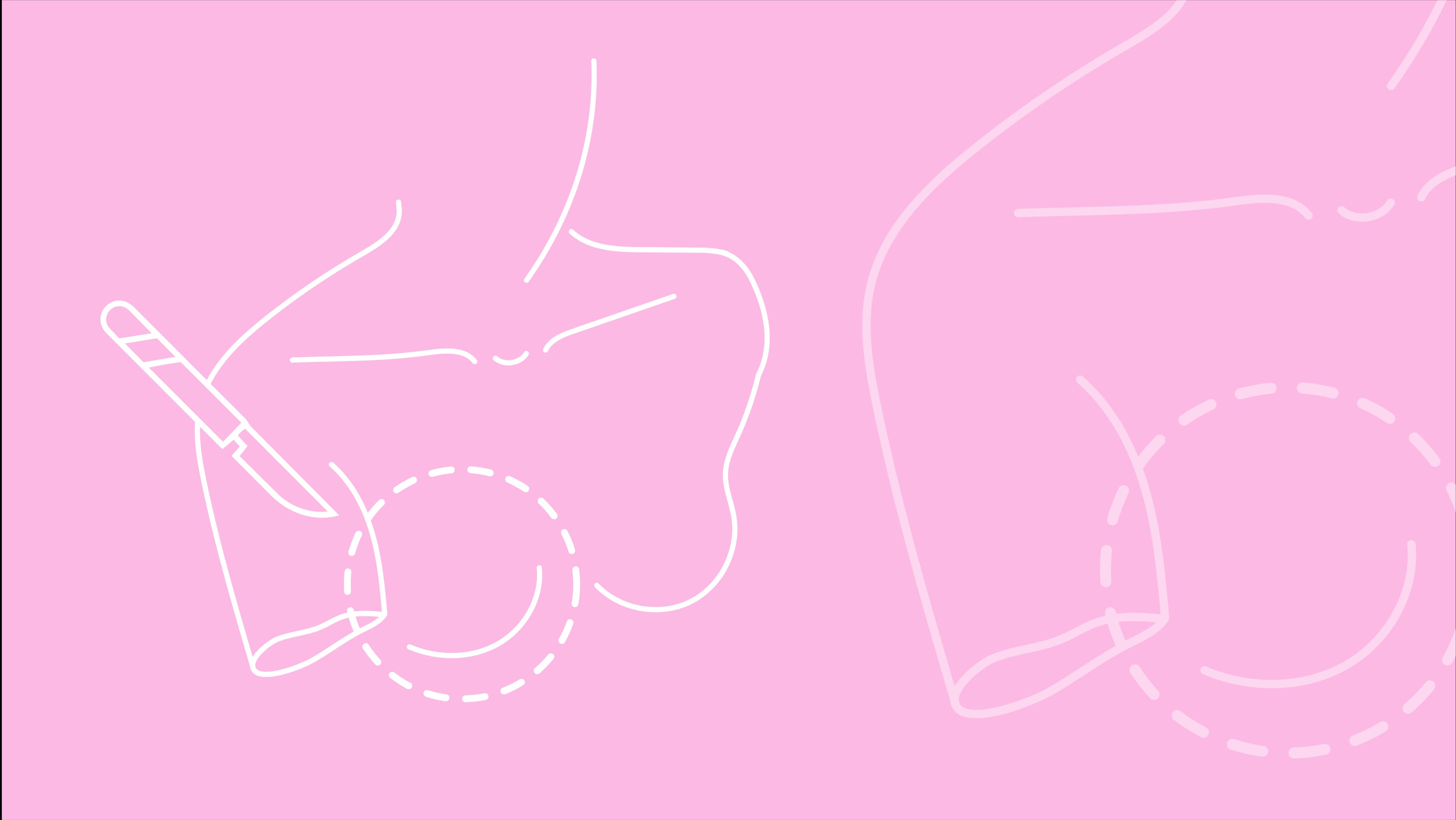 Mastoplastica Additiva Preservé